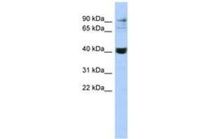 Image no. 1 for anti-Matrix Metallopeptidase 3 (Stromelysin 1, Progelatinase) (MMP3) (C-Term) antibody (ABIN6743087) (MMP3 antibody  (C-Term))