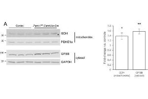 Western Blotting (WB) image for anti-phosphorylase, Glycogen, Brain (GPBB) (C-Term) antibody (ABIN2855804)