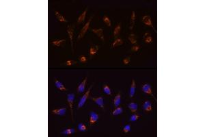 Immunofluorescence analysis of HeLa cells using [KO Validated] SLC25/ Rabbit mAb (ABIN7270428) at dilution of 1:100 (40x lens). (SLC25A4 antibody)