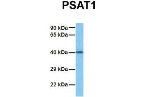 Host:  Rabbit  Target Name:  PSAT1  Sample Tissue:  Human Fetal Kidney  Antibody Dilution:  1. (PSAT1 antibody  (N-Term))