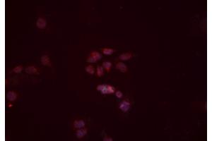 ABIN6277442 staining Hela cells by IF/ICC. (TRIM63 antibody  (N-Term))
