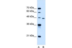 Western Blotting (WB) image for anti-Solute Carrier Family 16, Member 12 (Monocarboxylic Acid Transporter 12) (SLC16A12) antibody (ABIN2462789)