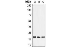 Western blot analysis of TNF beta expression in HeLa (A), Human tonsil (B), Human lymph node (C) whole cell lysates.