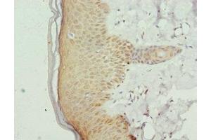 Immunohistochemistry of paraffin-embedded human skin tissue using ABIN7153413 at dilution of 1:100 (GABPB1 antibody  (AA 231-395))