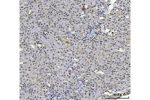 IHC analysis of HOXC4 using anti-HOXC4 antibody (ABIN7603059). (HOXC4 antibody  (Middle Region))