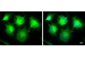 ICC/IF Image IKBKE antibody [N2C3] detects IKBKE protein at cytoplasm by immunofluorescent analysis. (IKKi/IKKe antibody)