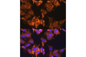 Immunofluorescence analysis of C6 cells using CDV3 Rabbit pAb (ABIN7266240) at dilution of 1:100. (CDV3 antibody)