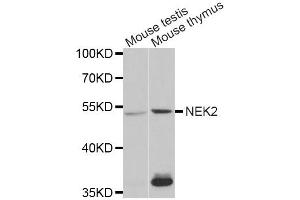 Western Blotting (WB) image for anti-NIMA (Never in Mitosis Gene A)-Related Kinase 2 (NEK2) antibody (ABIN1876543) (NEK2 antibody)