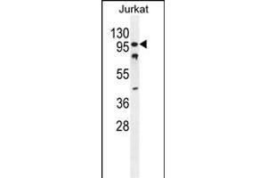 CWC22 Antibody (N-term) (ABIN654743 and ABIN2844428) western blot analysis in Jurkat cell line lysates (35 μg/lane). (CWC22 antibody  (N-Term))