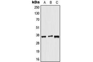 Western blot analysis of ALX3 expression in HeLa (A), NIH3T3 (B), rat brain (C) whole cell lysates. (ALX3 antibody  (Center))