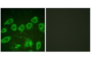 Immunofluorescence analysis of HuvEc cells, using Tyrosine Hydroxylase (epitope around residue 19) antibody (ABIN5976157). (Tyrosine Hydroxylase antibody  (Ser19))