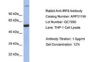 WB Suggested Anti-IRF8 Antibody   Titration: 1. (IRF8 antibody  (C-Term))