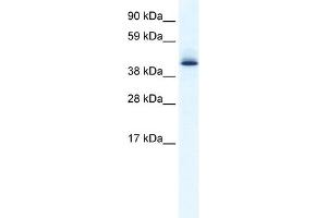 WB Suggested Anti-AATF Antibody Titration: 0. (AATF antibody  (N-Term))