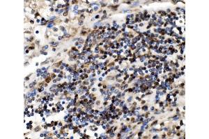 IHC analysis of NOLA1/GAR1 using anti-NOLA1/GAR1 antibody (ABIN7602076). (GAR1 antibody  (AA 58-165))