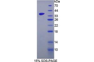 Image no. 1 for serine/arginine-Rich Protein Specific Kinase 3 (SRPK3) (AA 220-506) protein (His tag) (ABIN4991075)