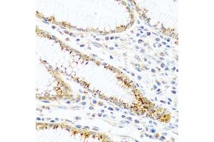 Immunohistochemistry of paraffin-embedded human stomach using FAM3B antibody (ABIN5970440) at dilution of 1/100 (40x lens).