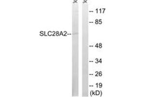 Western blot analysis of extracts from Jurkat cells, using SLC28A2 Antibody. (SLC28A2 antibody  (AA 371-420))
