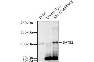 Immunoprecipitation analysis of 300 μg extracts of K-562 cells using 3 μg S antibody (ABIN7270152). (SATB2 antibody)