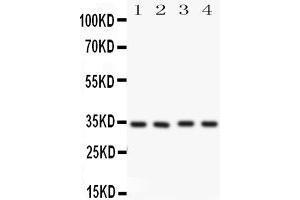 Anti-Caspase-7(P11) antibody, Western blotting All lanes: Anti CASP7(p11)  at 0. (Caspase 7 antibody  (Middle Region))