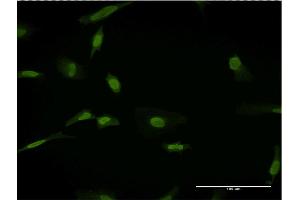 Immunofluorescence of monoclonal antibody to SLC11A2 on HeLa cell. (SLC11A2 antibody  (AA 1-65))