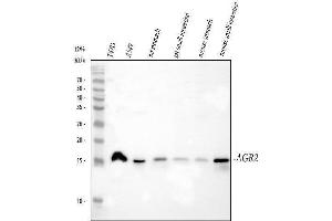 Western blot analysis of AGR2 using anti-AGR2 antibody (ABIN5518726). (AGR2 antibody  (AA 21-175))