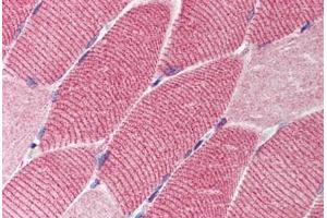 Human Skeletal Muscle (formalin-fixed, paraffin-embedded) stained with TSC1 antibody ABIN214539 at 2. (TSC1 antibody)