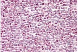 Anti-HCFC1 / HCF-1 antibody IHC staining of human tonsil. (HCFC1 antibody  (AA 131-180))