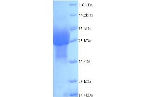 SDS-PAGE (SDS) image for Poliovirus Receptor-Related 4 (PVRL4) (AA 32-349) protein (His tag) (ABIN5714424) (PVRL4 Protein (AA 32-349) (His tag))