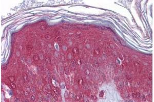 Human Skin: Formalin-Fixed, Paraffin-Embedded (FFPE) (FGFR1 antibody  (N-Term))