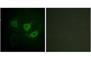 Immunofluorescence analysis of HuvEc cells, using p70 S6 Kinase (Phospho-Thr389) Antibody. (RPS6KB1 antibody  (pThr412))