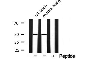 Western blot analysis of extracts of various samples,using akt1/3 Antibody. (AKT1/3 antibody)