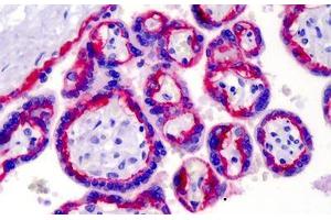 Human Placenta: Formalin-Fixed, Paraffin-Embedded (FFPE) (Integrin beta 4 antibody)