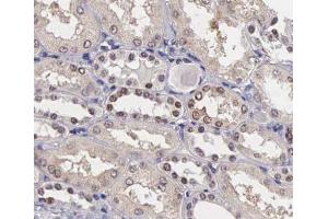 ABIN6267405 at 1/200 staining human kidney tissue sections by IHC-P.