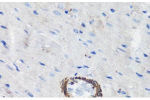 Immunohistochemistry of paraffin-embedded Rat heart using FLNA Polyclonal Antibody at dilution of 1:100 (40x lens). (Filamin A antibody)