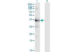 Western Blotting (WB) image for anti-Hydroxy-delta-5-Steroid Dehydrogenase, 3 beta- and Steroid delta-Isomerase 1 (HSD3B1) (AA 1-373) antibody (ABIN561369)
