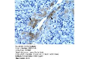 Rabbit Anti-GATA3 Antibody  Paraffin Embedded Tissue: Human Liver Cellular Data: Hepatocyte Antibody Concentration: 4.