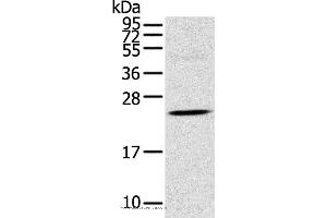 Western blot analysis of Human fetal brain tissue, using TSPAN13 Polyclonal Antibody at dilution of 1:550 (TSPAN13 antibody)