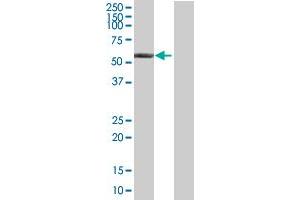 Western Blot analysis of ALDH6A1 expression in transfected 293T cell line by ALDH6A1 MaxPab polyclonal antibody. (ALDH6A1 antibody  (AA 1-535))