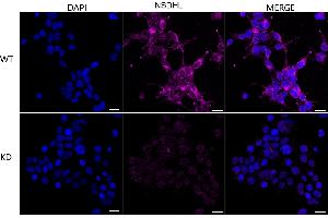 anti-NAD(P) Dependent Steroid Dehydrogenase-Like (NSDHL) antibody
