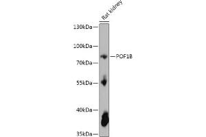 Western blot analysis of extracts of Rat kidney, using POF1B antibody (ABIN7269509) at 1:1000 dilution.