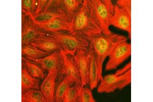 IF analysis of FTO using anti-FTO antibody (ABIN7601059) and anti-Tubulin Alpha antibody (ABIN7600339).