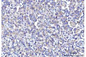 IHC analysis of RPS5 using anti-RPS5 antibody (ABIN7599076). (RPS5 antibody  (AA 1-204))