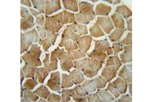 Immunohistochemistry analysis human skeletal muscle (Formalin-fixed, Paraffin-embedded) using MRM1 Antibody (N-term), followed by peroxidase conjugated secondary antibody and DAB staining. (MRM1 antibody  (N-Term))