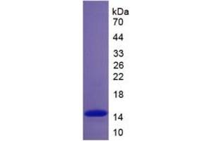 SDS-PAGE of Protein Standard from the Kit  (Highly purified E. (Complement Factor B ELISA Kit)