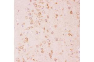 Anti-Tuberin Picoband antibody,  IHC(P): Rat Brain Tissue (Tuberin antibody  (AA 1611-1807))