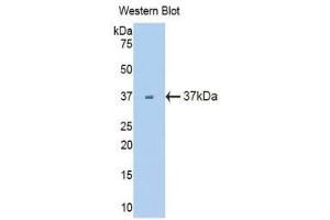 Western Blotting (WB) image for anti-Fms-Related tyrosine Kinase 1 (VEGFR1) (FLT1) (AA 27-329) antibody (ABIN3206010) (FLT1 antibody  (AA 27-329))