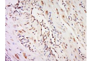 Paraformaldehyde-fixed, paraffin embedded mouse placenta, Antigen retrieval by boiling in sodium citrate buffer (pH6) for 15min, Block endogenous peroxidase by 3% hydrogen peroxide for 30 minutes, Blocking buffer (normal goat serum) at 37°C for 20min, Antibody incubation with 	NOR1 Polyclonal Antibody, Unconjugated  at 1:500 overnight at 4°C, followed by a conjugated secondary and DAB staining. (NR4A3 antibody  (AA 521-626))