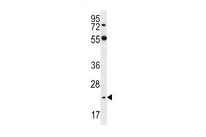 Neurogenin2 Antibody  (ABIN388769 and ABIN2839073) western blot analysis in Hela cell line lysates (35 μg/lane). (Neurogenin 2 antibody  (C-Term))