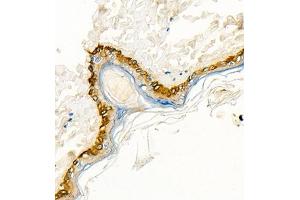 Immunohistochemistry of paraffin embedded rat skin using CK13 (ABIN7074412) at dilution of 1:1500 (400x lens) (Cytokeratin 13 antibody  (N-Term))