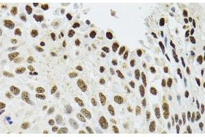 Immunohistochemistry (Paraffin-embedded Sections) (IHC (p)) image for anti-Splicing Factor Proline/glutamine-Ric (SFPQ) antibody (ABIN7255047)